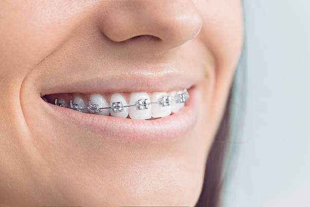Best Root Canal Treatment  in North Sarasota, FL